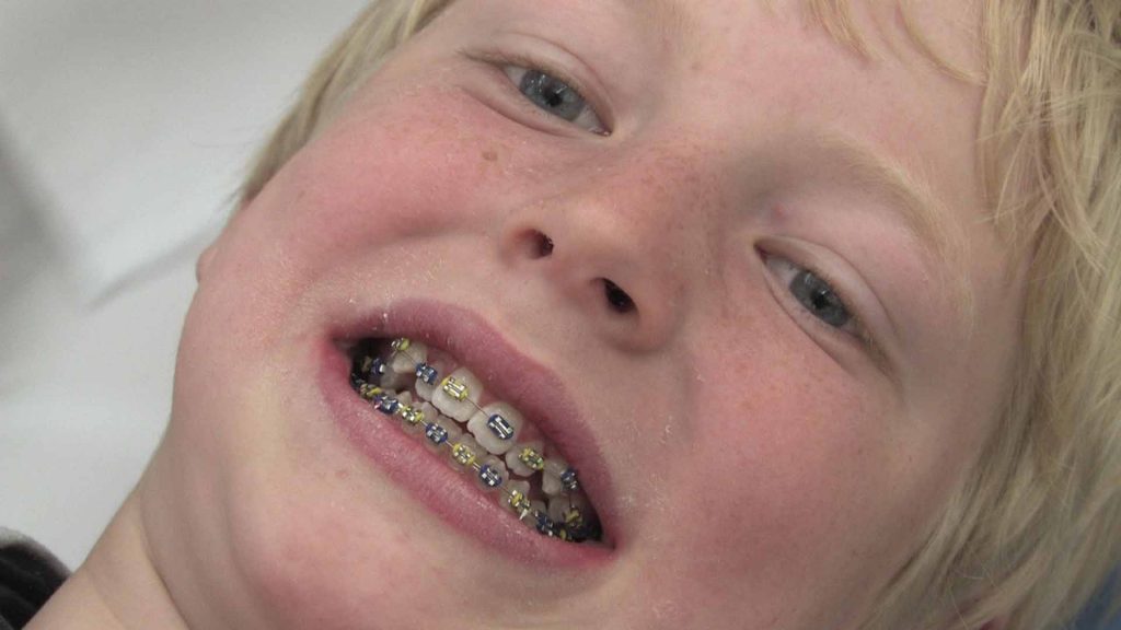 Serie webvideo's over het krijgen van een beugel voor de Orthodontiepraktijk Leeuwarden